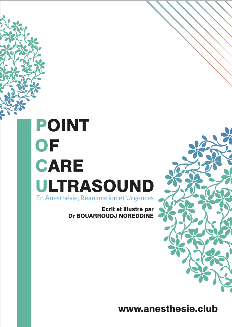 POINT OF CARE ULTRASOUND (POCUS)En Anesthésie,Réanimation et Urgences